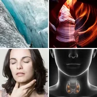 Les quatre images du niveau 910 de 4 Images 1 Mot