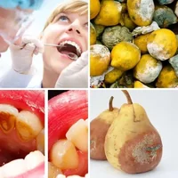 Les quatre images du niveau 578 de 4 Images 1 Mot