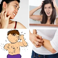 Les quatre images du niveau 729 de 4 Images 1 Mot